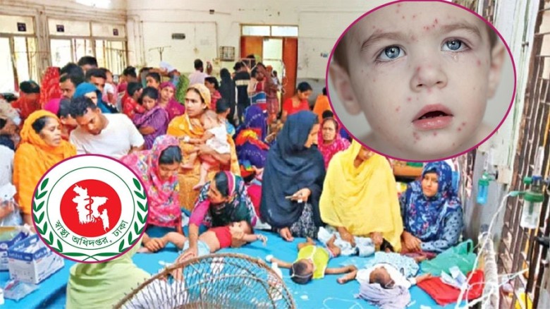 ২৪ ঘণ্টায় হাম ও উপসর্গে ৭ শিশুর মৃত্যু, হাসপাতালে ভর্তি ৭২৯ 